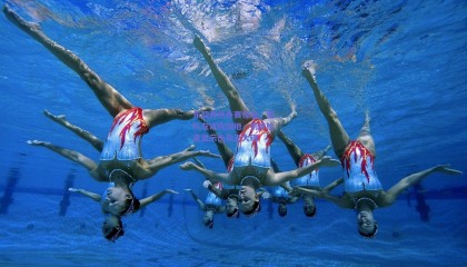 东契奇热身赛惊魂，遭队友误伤倒地，初步检查显示伤势无大碍